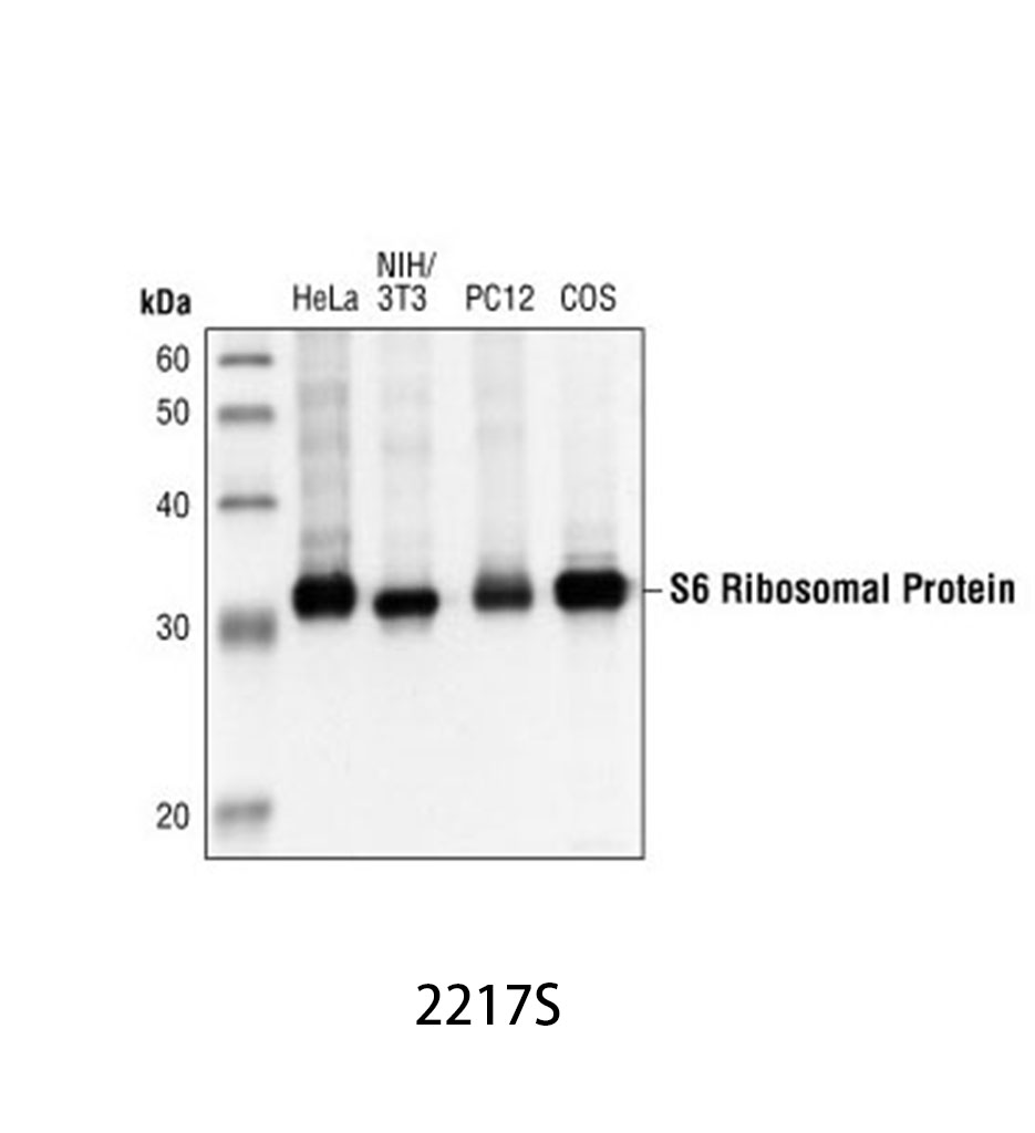 S6 Ribosomal Protein (5G10) Rabbit mAb