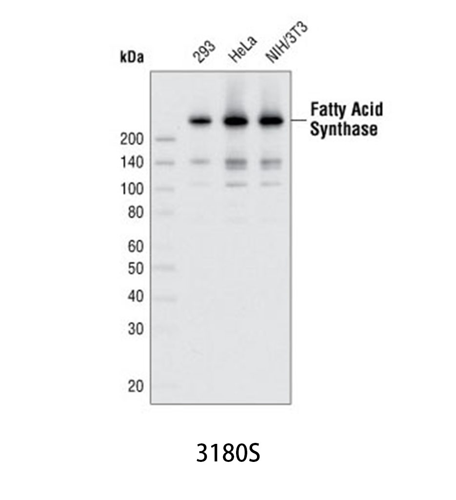 Fatty Acid Synthase (C20G5) Rabbit mAb