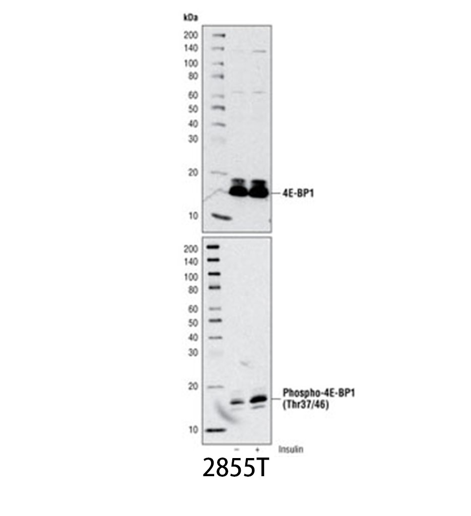 Phospho-4E-BP1 (Thr37/46) (236B4) Rabbit mAb