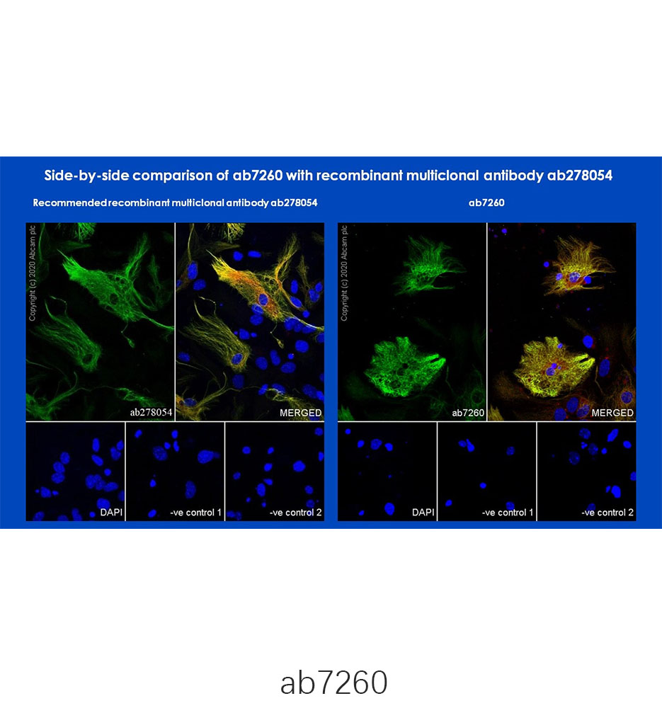 Anti-GFAP抗体(ab7260)