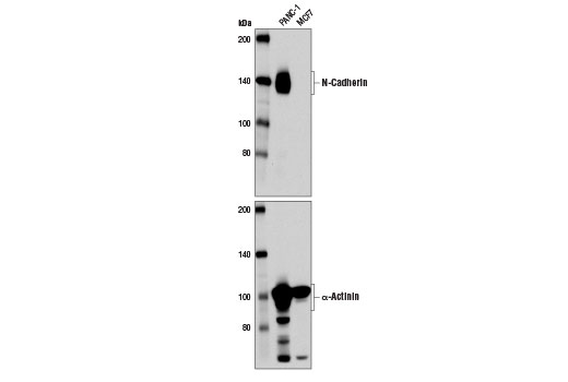N-Cadherin (13A9) Mouse mAb
