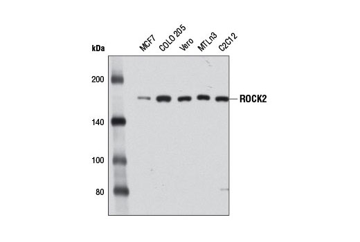 ROCK2 (D1B1) Rabbit mAb