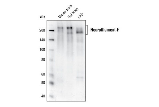 Neurofilament-H (RMdO 20) Mouse mAb