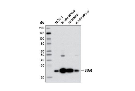 StAR (D10H12) XP Rabbit mAb