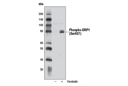 Phospho-DRP1 (Ser637) (D3A4) Rabbit mAb
