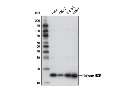Histone H2B (D2H6) Rabbit mAb