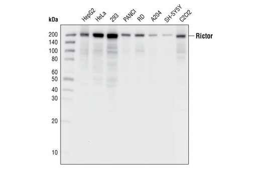 Rictor (53A2) Rabbit mAb