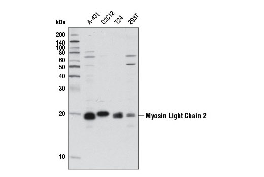 Myosin Light Chain 2 (D18E2) Rabbit mAb