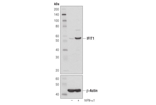 IFIT1 (D2X9Z) Rabbit mAb