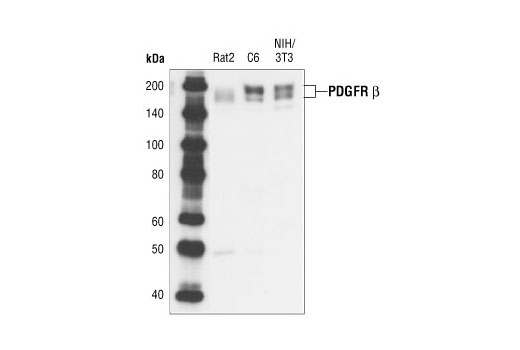 PDGF Receptor β (28E1) Rabbit mAb