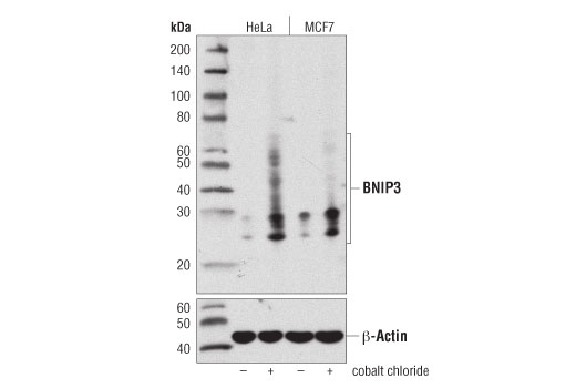 BNIP3 (D7U1T) Rabbit mAb
