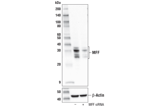 MFF (E5W4M) XP Rabbit mAb