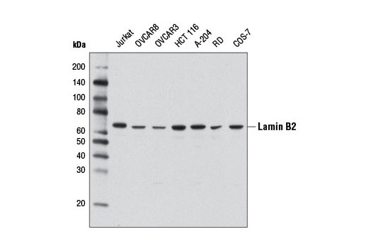 Lamin B2 (D8P3U) Rabbit mAb