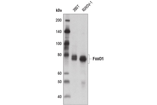 FoxO1 (D7C1H) Mouse mAb