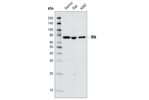 Btk (C82B8) Rabbit mAb