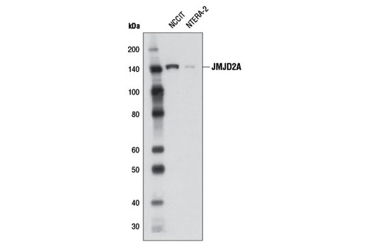 JMJD2A (C37E5) Rabbit mAb