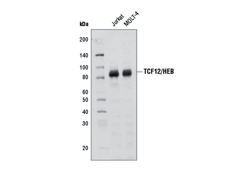 TCF12/HEB (D2C10) Rabbit mAb