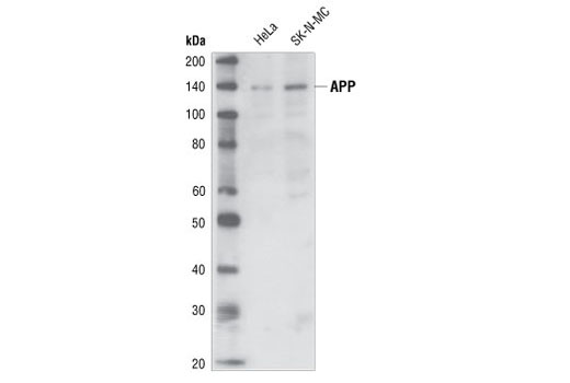 APP/β-Amyloid (NAB228) Mouse mAb