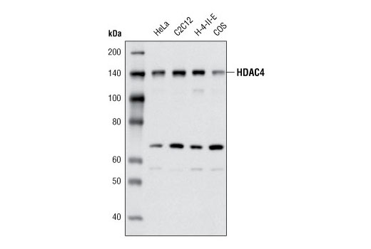 HDAC4 (4A3) Mouse mAb