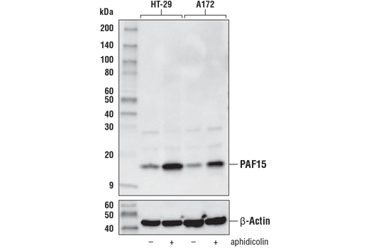 PAF15 (D8E2Y) XP Rabbit mAb