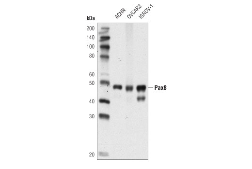 PAX8 (D2S2I) Rabbit mAb