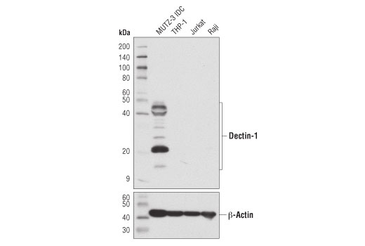 Dectin-1 (E1X3Z) Rabbit mAb