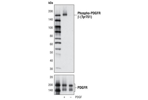 Phospho-PDGF Receptor β (Tyr751) (C63G6) Rabbit mAb