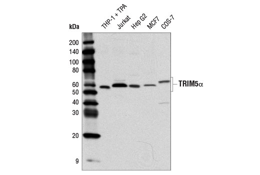 TRIM5α (D6Z8L) Rabbit mAb