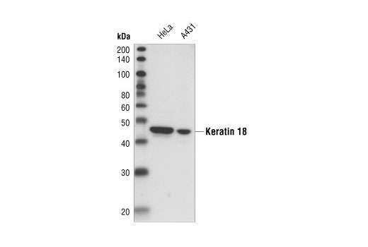Keratin 18 (DC10) Mouse mAb
