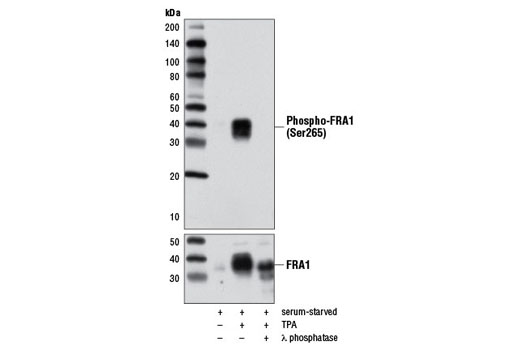 Phospho-FRA1 (Ser265) (D22B1) Rabbit mAb