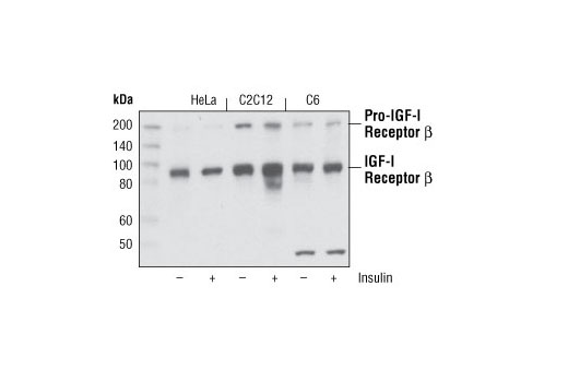 IGF-I Receptor β (111A9) Rabbit mAb