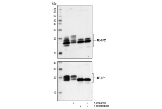 4E-BP2 Antibody
