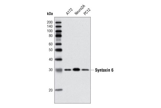 Syntaxin 6 (C34B2) Rabbit mAb