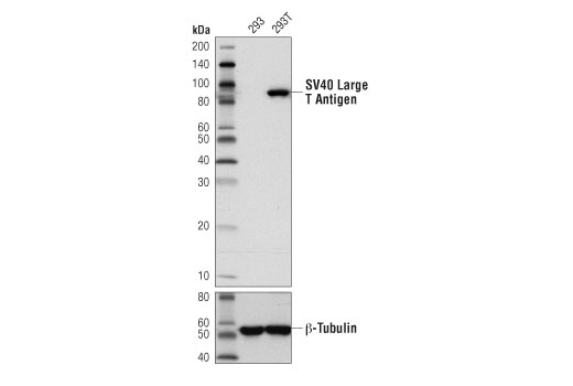 Hypoxia Pathway Antibody Sampler Kit