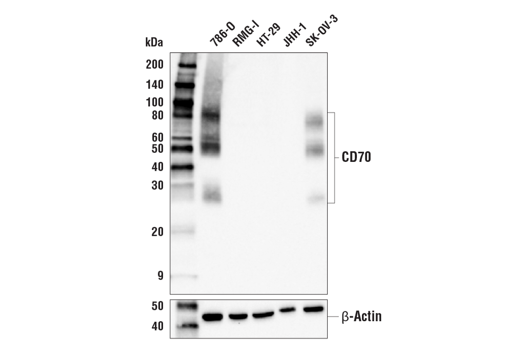 CD70 (E3Q1A) Rabbit Monoclonal Antibody