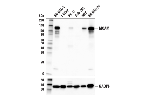 MCAM (E3F3E) Rabbit Monoclonal Antibody