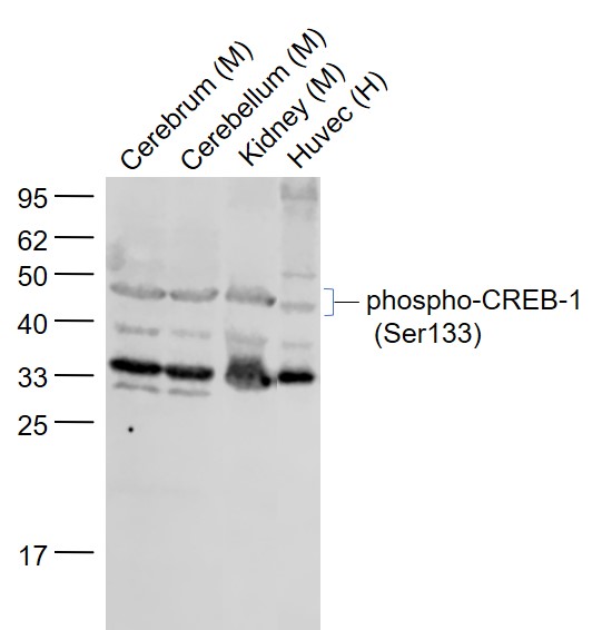 磷酸化CREB-1抗体