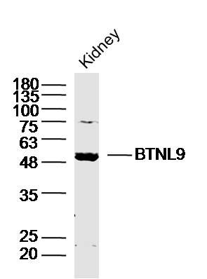嗜乳脂蛋白样9抗体