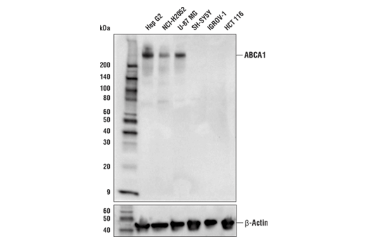 ABCA1 (E7X5G) Rabbit mAb