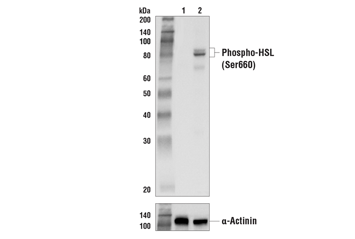 Phospho-HSL (Ser660) Antibody