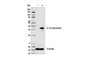 Pyroptosis Antibody Sampler Kit