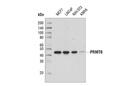 PRMT6 (D5A2N) Rabbit mAb