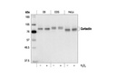 Cortactin Antibody